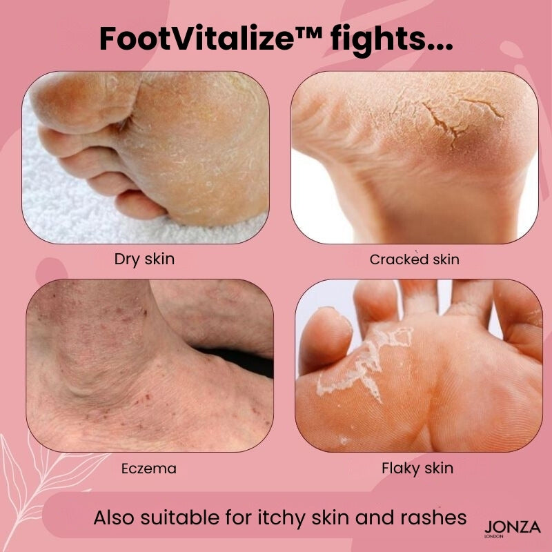 1+1 FREE TODAY | FootVitalize™ - Foot Restoring Cream