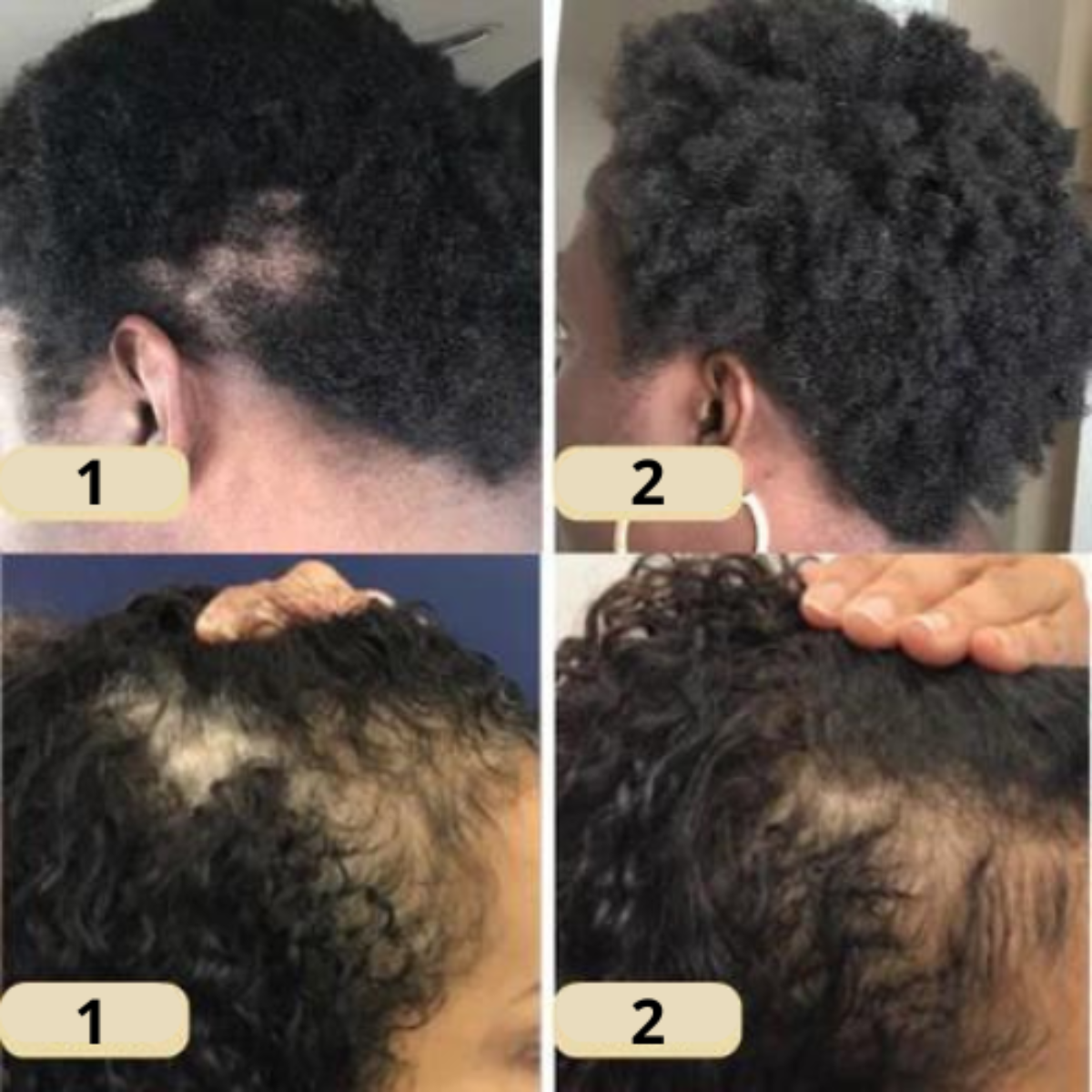 Natural oil for rapid hair growth