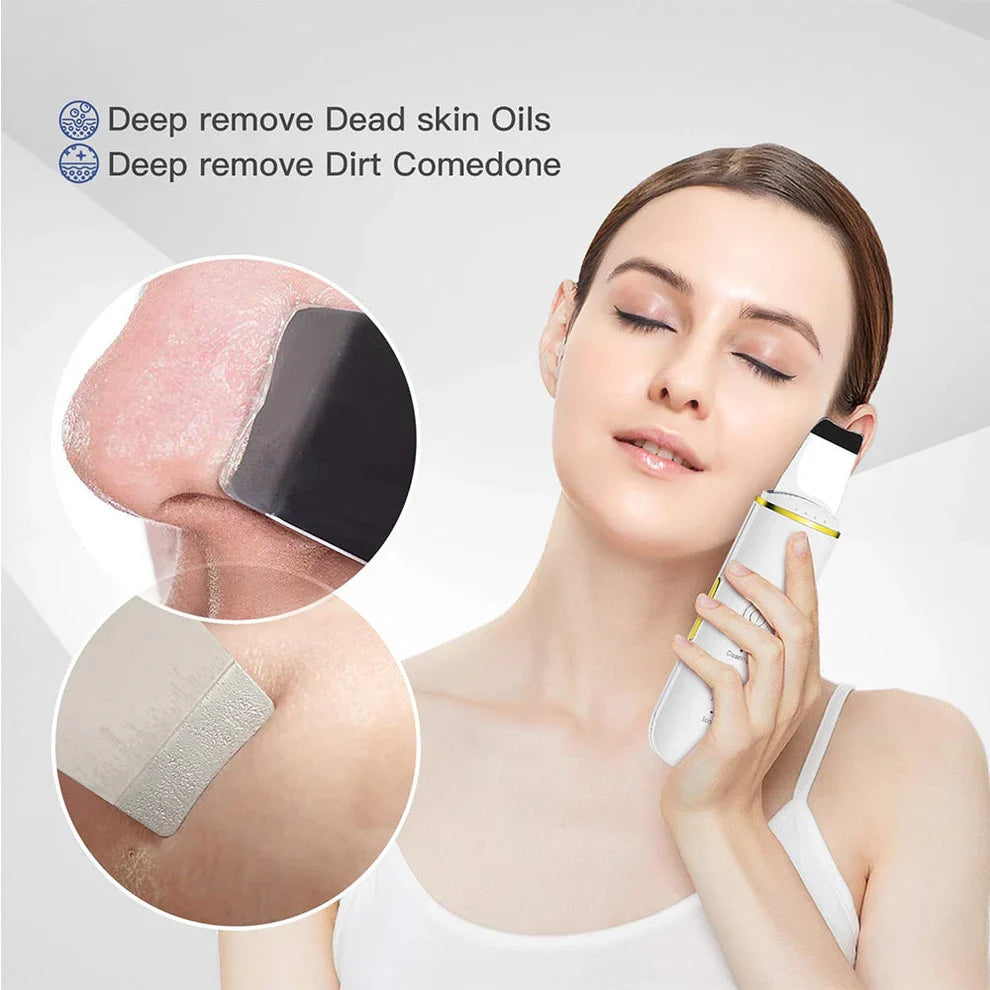 Blackhead Remover - ultrasonic technology deep cleans your pores and boost circulation