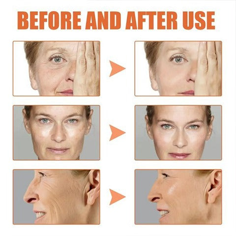 Sérum de Essência Facial com Botox