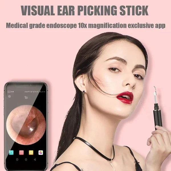 ProScope™ Smart Ear Cleaner