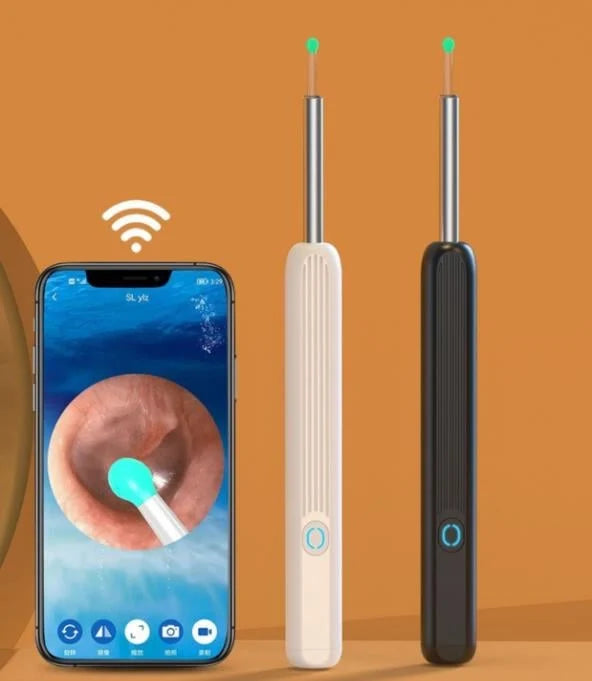 ProScope™ Smart Ear Cleaner