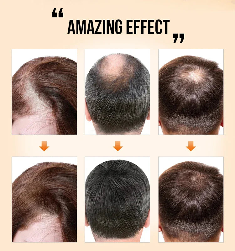 EvoGrow Oil™ -  healthier, fuller, and shinier hair