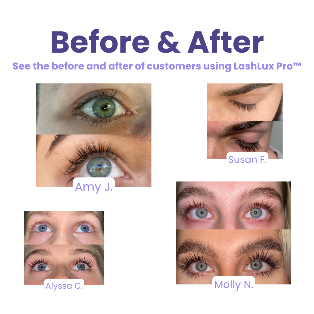 LashLux Pro™ - Wimpernwachstumsserum