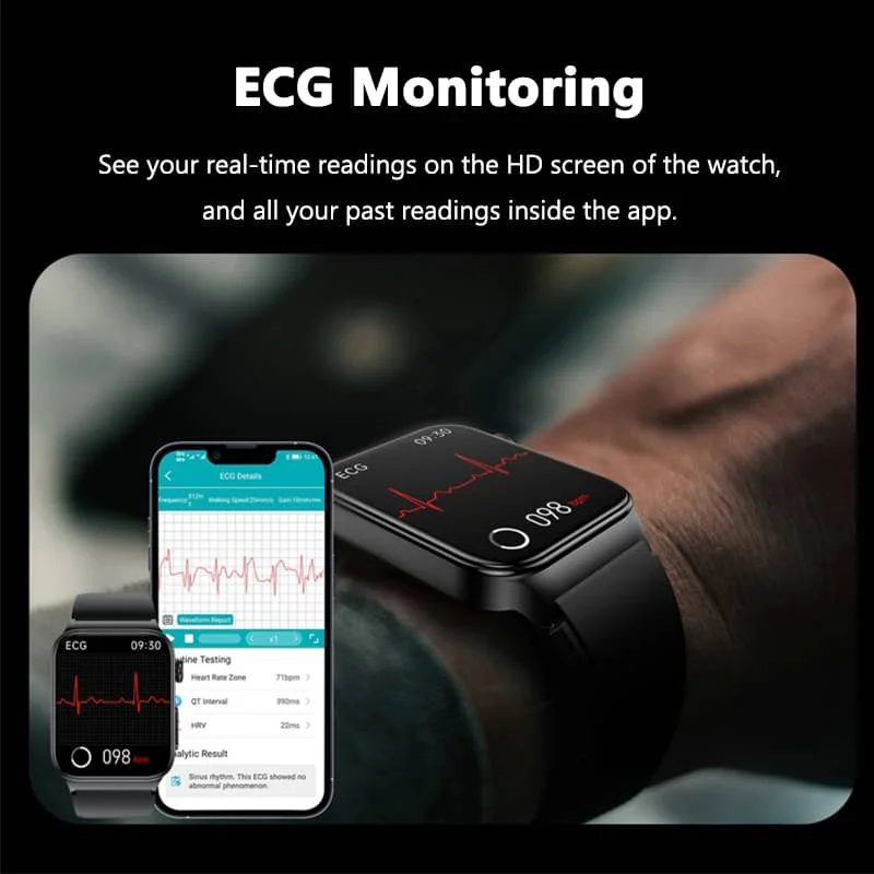 All-in-One Health Monitoring Smartwatch with ECG & Blood Glucose Tracker