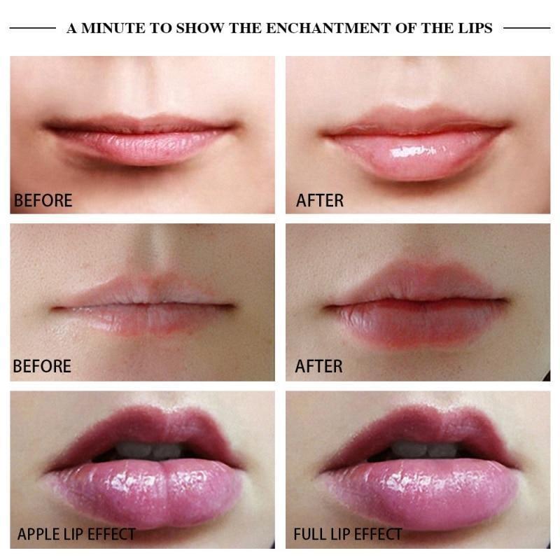 Electric Automatic Lip Plumping Device